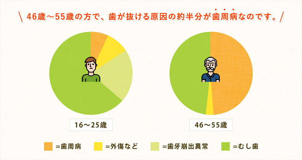 歯周病も歯が抜ける大きな原因